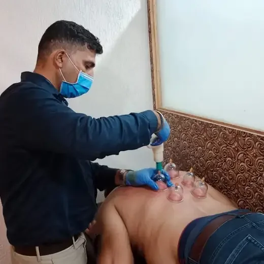 A masked physiotherapist performing cupping therapy on a patient&rsquo;s back.
